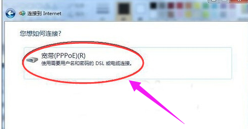 寬帶設(shè)置 寬帶設(shè)置